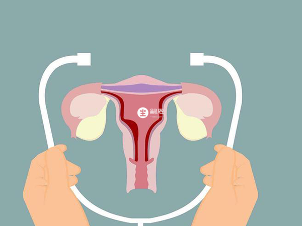 多囊卵巢綜合徵多在青春期發病