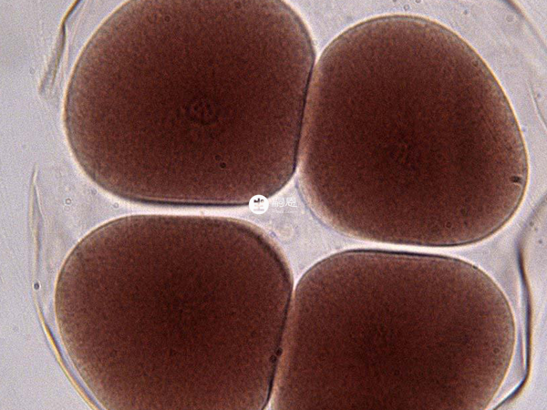 FSH高卵泡質量可能不太好