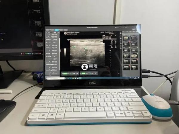 懷孕早期做B超需要憋尿