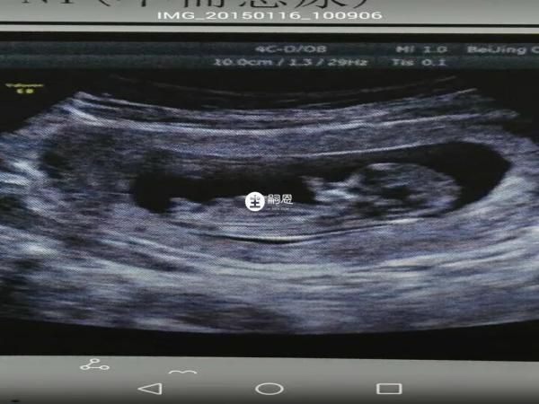 B超檢查可以推算懷孕天數
