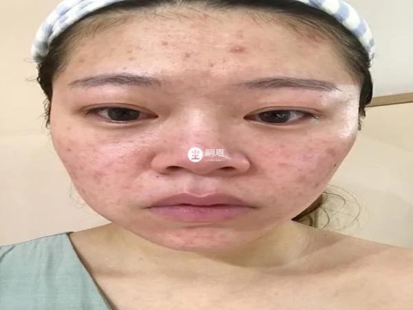 懷孕40天面板差是懷的男孩