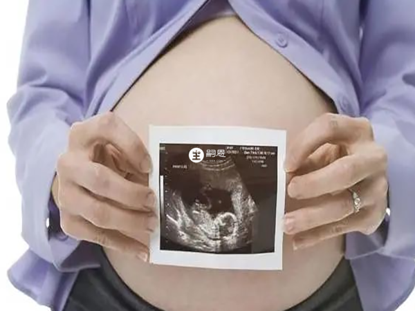 無創dna適用於35歲高齡孕婦