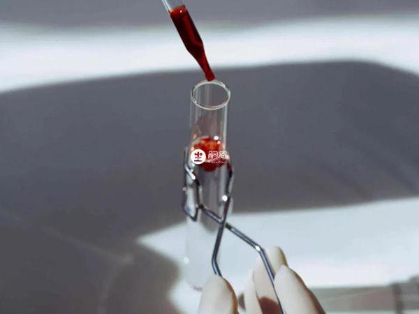 年齡高低會影響無創檢查