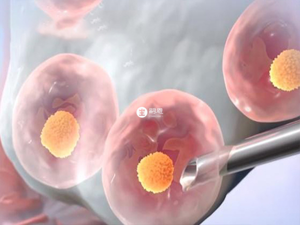 促排取卵是北京供精試管流程之一