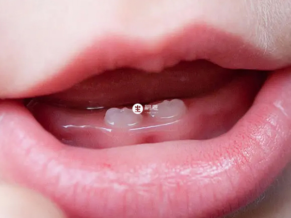 寶寶長牙早晚主要跟遺傳和環境有關