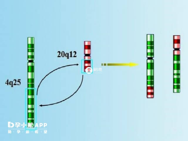 羅伯遜易位的患者不多