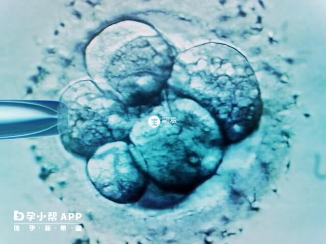 卵子是用取卵針取出來的