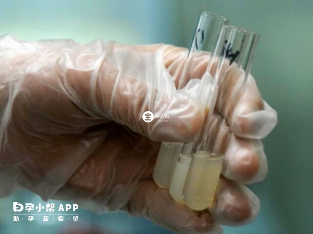 精子顏色為灰白或者是淡黃色的