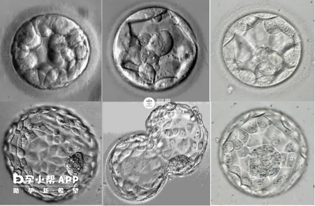 試管囊胚劃分標準