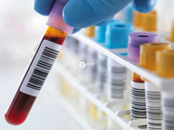 精液暗紅色的治療方法