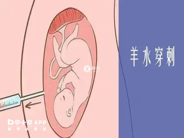 三代試管成功懷孕後還要做羊穿