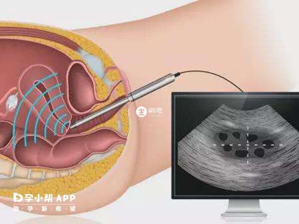 北醫三院人工授精成功率高