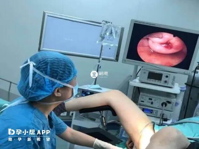 做宮腔鏡後不一定要儘快移植