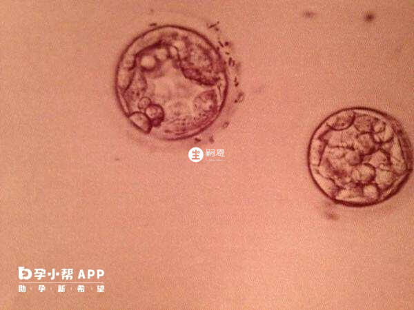 囊胚發育緩慢通知時間就會較晚