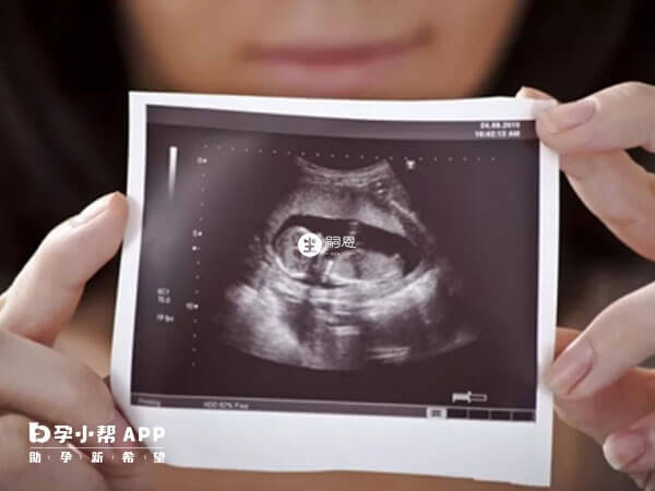 四维彩超看男女的诀窍没有根据