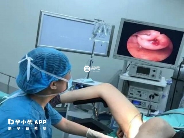 宮腔鏡手術有陰道出血的風險