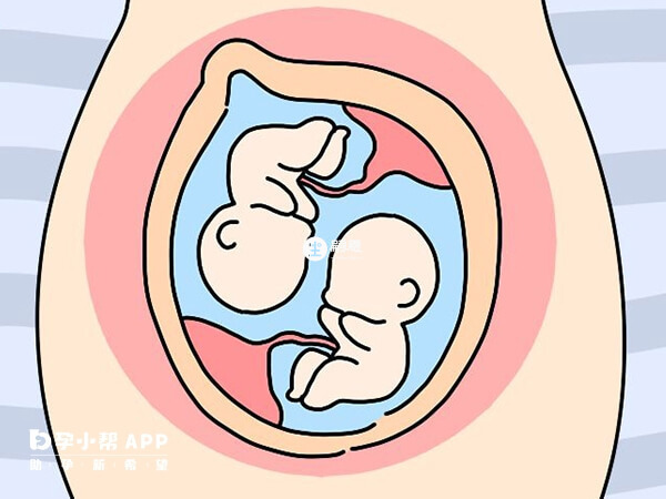 試管雙胎分單卵和雙卵