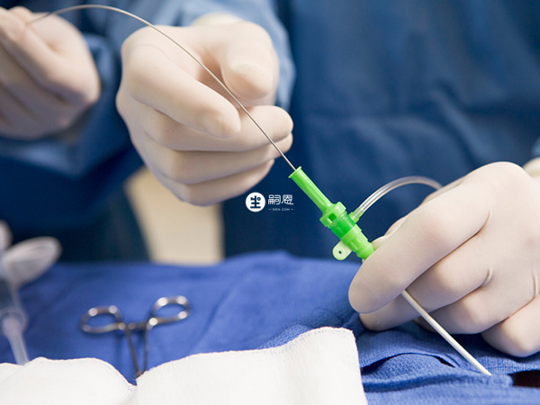 供精試管嬰兒的過程