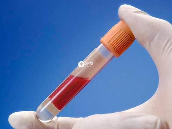 孕婦做無創只需抽取外周血送檢即可