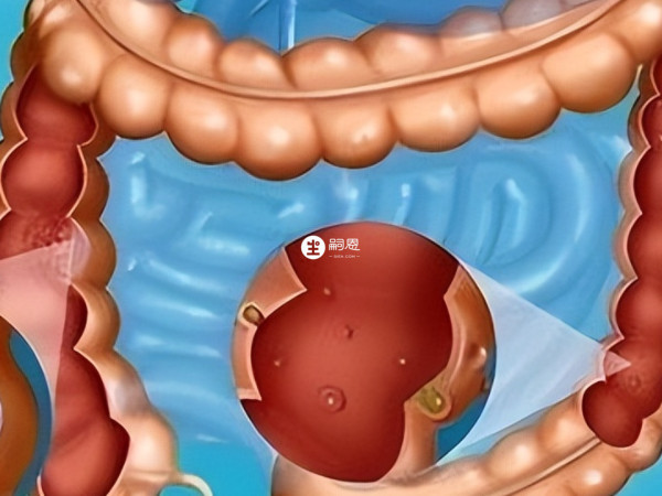 卓萃天然乳脂可降低便祕機率