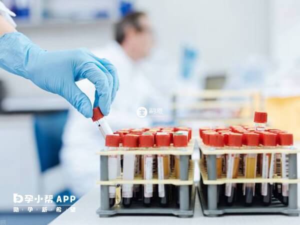 試管前先進行血常規等檢查