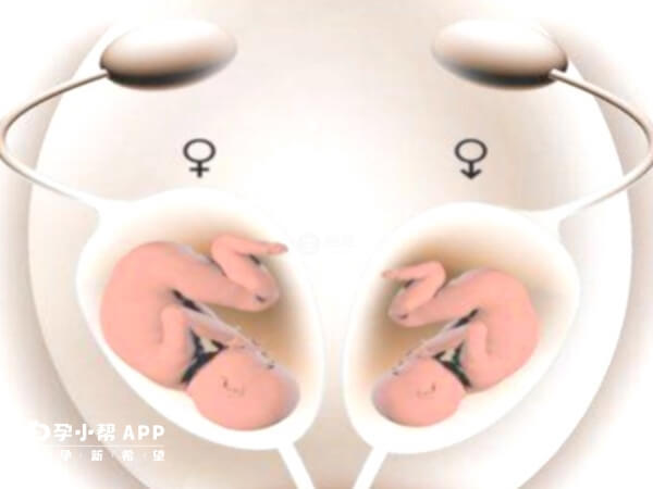 試管生龍鳳胎機率很小