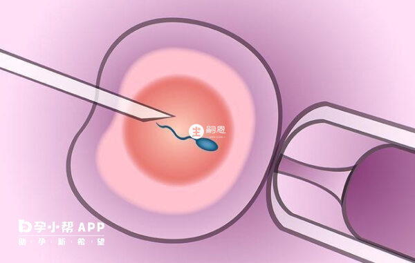 銀川有兩家生殖醫院可做人工授精