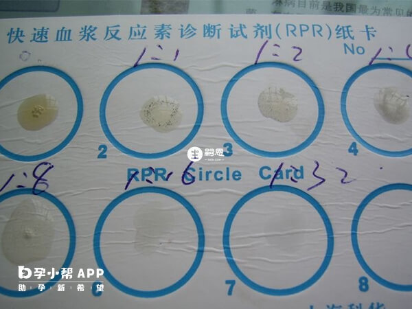 試管前要進一步檢測RPR滴度