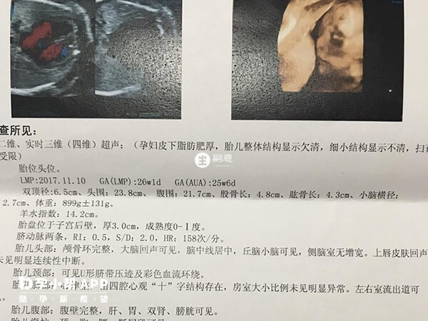 生儿子的四维彩超图片