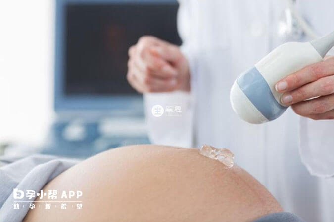 nt單不能看胎兒性別