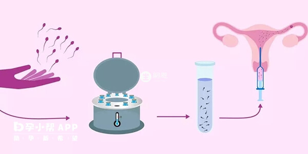 做供精試管兩女人才能生孩子