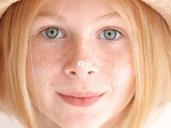 女性臉上長斑的解決方法