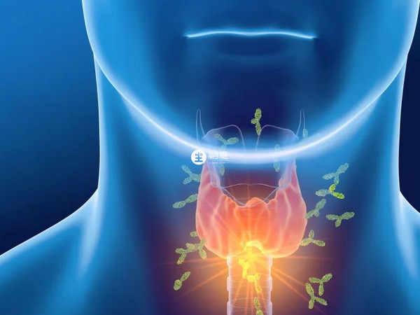 甲狀腺炎也可以引起甲亢