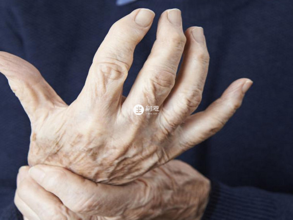 類風溼性關節炎的症狀