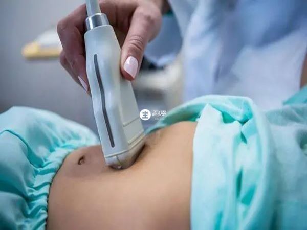 試管移植胎停育的症狀