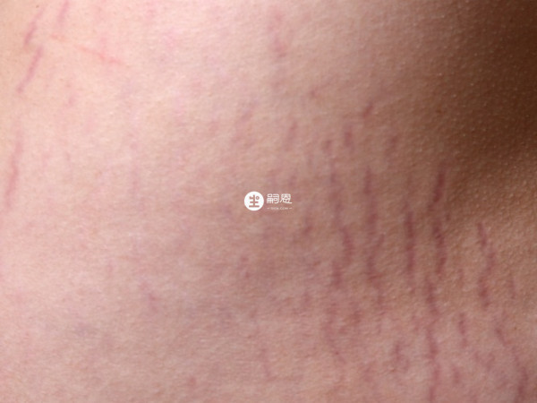 腹部顏色與其他部位不一樣也會長