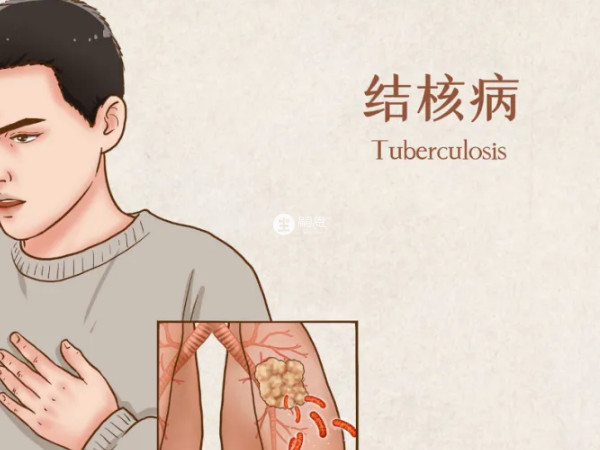 卡介苗可以預防兒童結核病