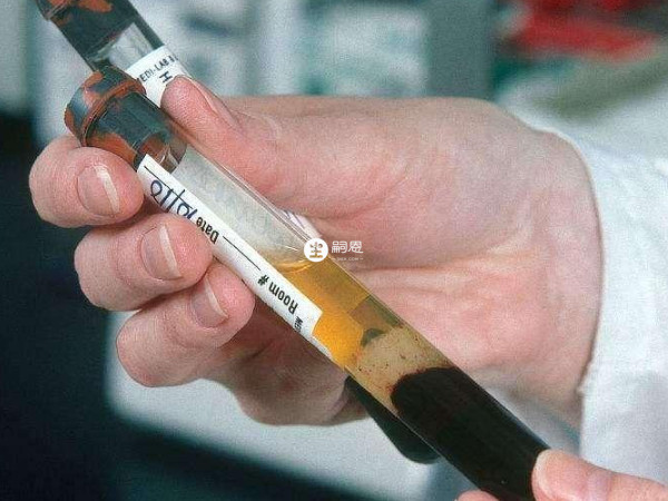 性激素的過度波動也會導致排卵時出血