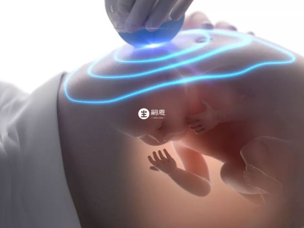 超聲波掃描也可以檢測男女