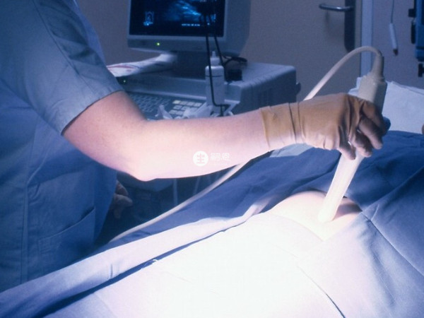 羊水穿刺可以通過胎兒染色體判斷性別