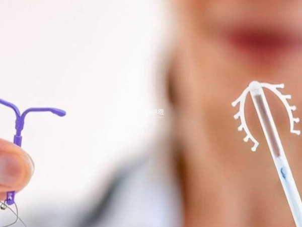 女性上環對身體有什麼影響