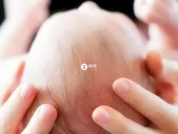 患有紅斑狼瘡的女性可以生小孩