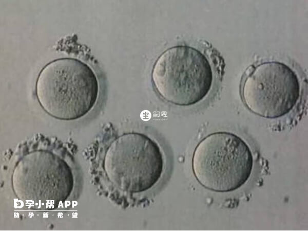 卵泡黄素化是怎么一回事