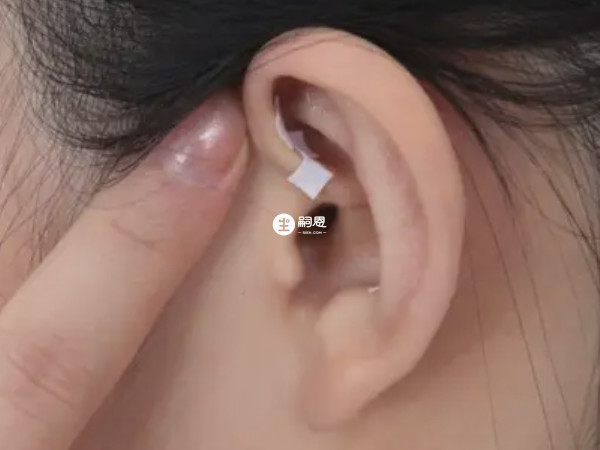 缓解孕吐常按摩耳穴