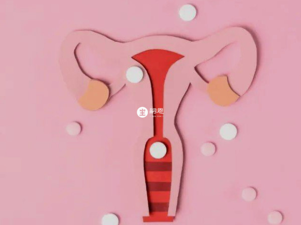 盆腔炎是女性上生殖道感染导致的炎症性疾病