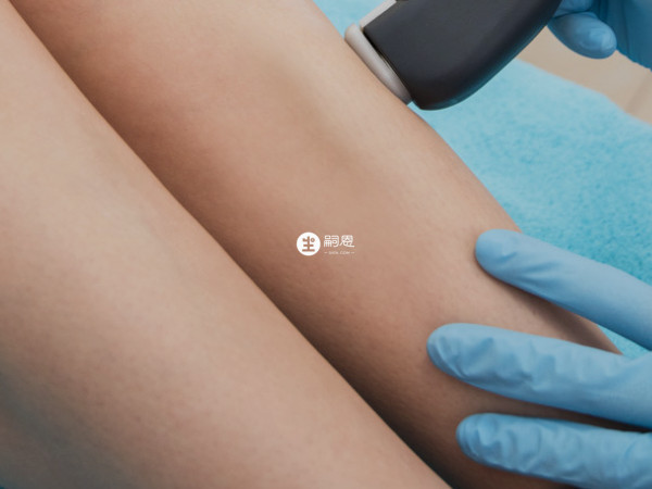 鐳射脫毛一般是利用鐳射的光熱作用