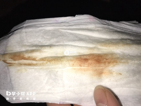 排卵期出血超過五天就要及時就醫