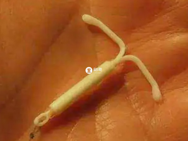 去醫院取環一般不需要預約