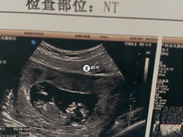 网传NT尾巴没翘就一定是女孩