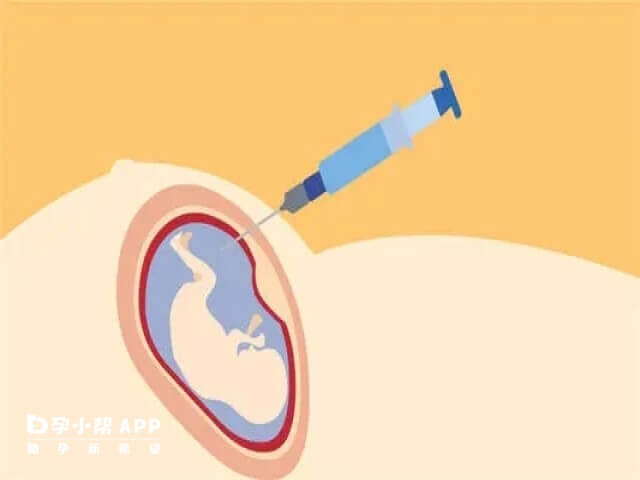 羊水穿刺檢查後兩週到四周左右才會有結果